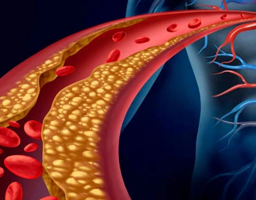 CANADI Clínica especializada en Diabetes y Endocrinología en Hidalgo